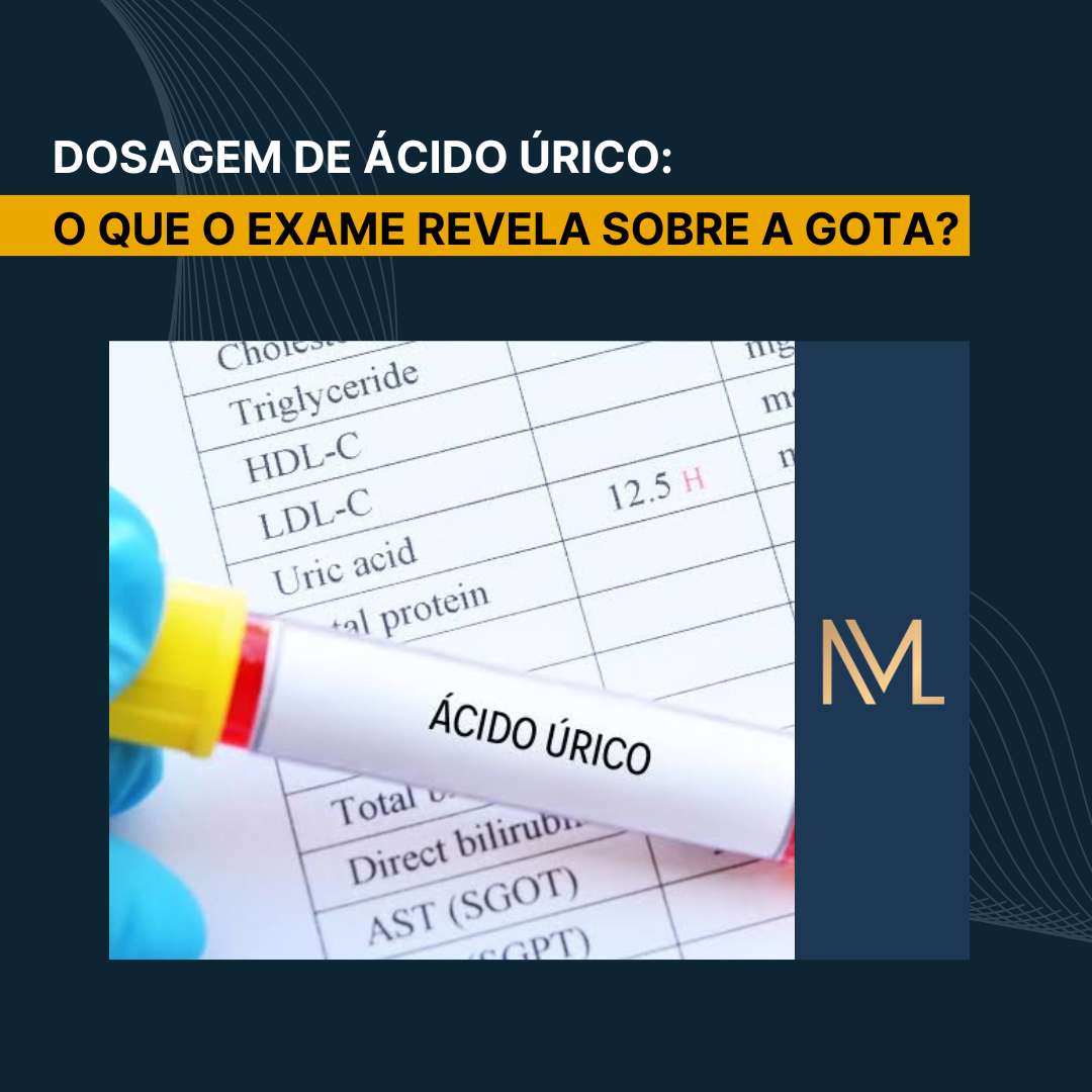 Ácido úrico: O que o exame revela sobre a gota? - INML