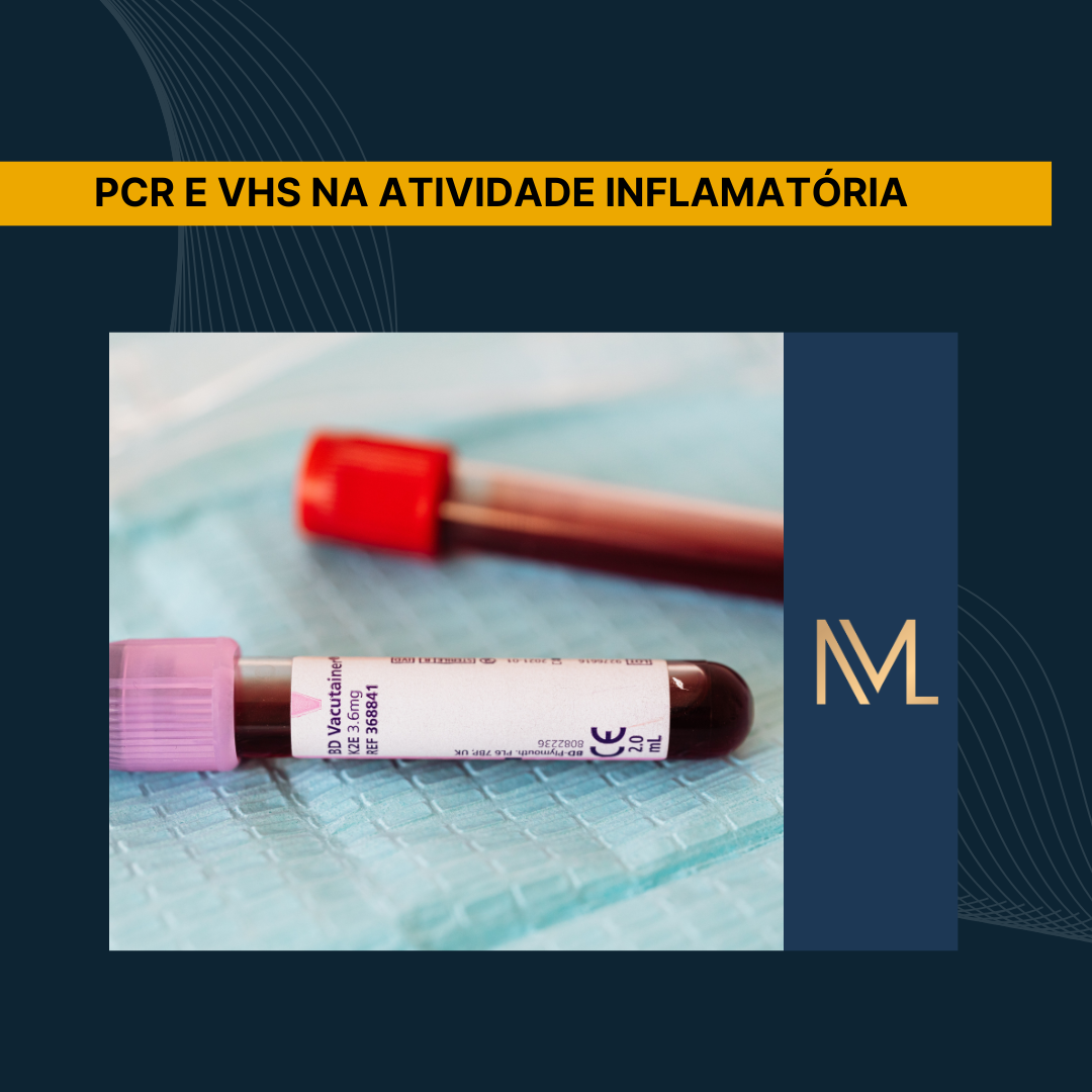 PCR e VHS na atividade inflamatória - INML