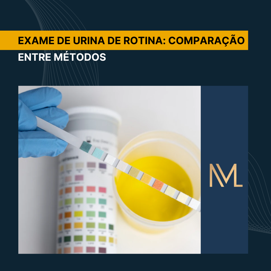 Exame de urina de rotina: comparação entre métodos - INML