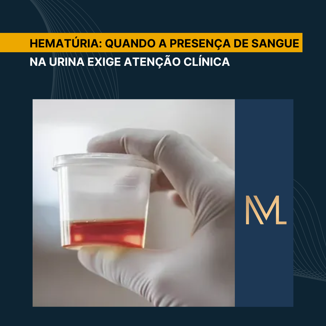 Hematúria: quando a presença de sangue na urina exige atenção clínica ...